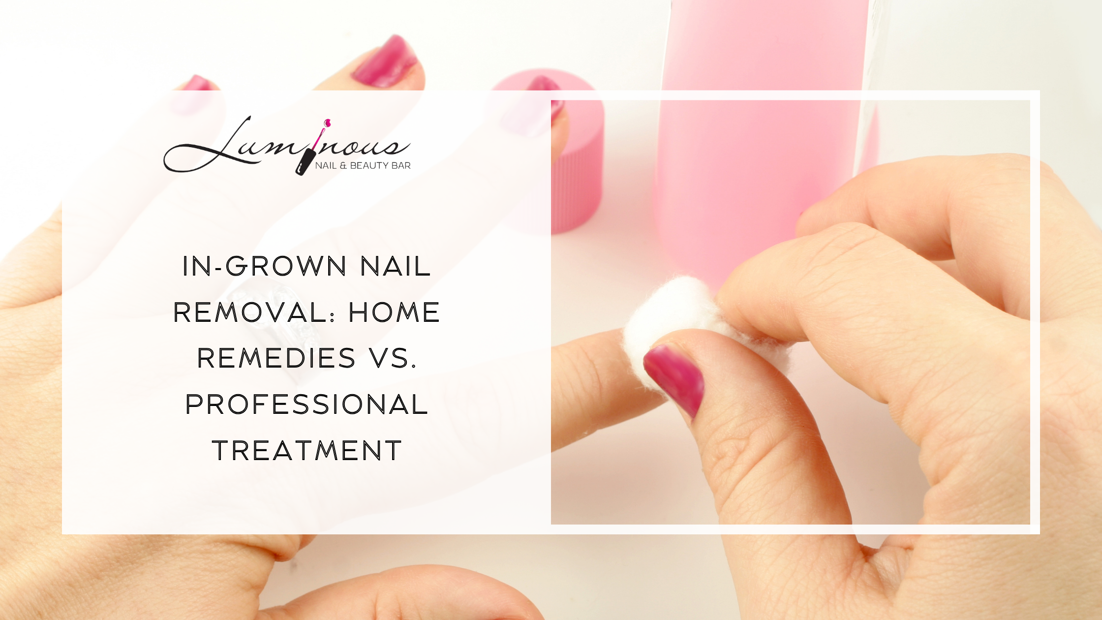 In-Grown Nail Removal
